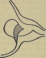 An illustration from Modern surgery, general and operative / by John Chalmers DaCosta. (1914)