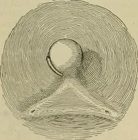 An illustration from Modern surgery, general and operative / by John Chalmers DaCosta. (1914)