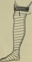 An illustration from Modern surgery, general and operative / by John Chalmers DaCosta. (1914)