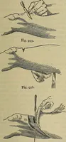 An illustration from Modern surgery, general and operative / by John Chalmers DaCosta. (1914)