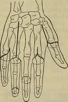 An illustration from Modern surgery, general and operative / by John Chalmers DaCosta. (1914)