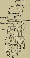 An illustration from Modern surgery, general and operative / by John Chalmers DaCosta. (1914)