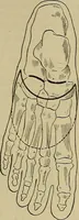An illustration from Modern surgery, general and operative / by John Chalmers DaCosta. (1914)