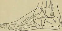 An illustration from Modern surgery, general and operative / by John Chalmers DaCosta. (1914)