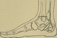 An illustration from Modern surgery, general and operative / by John Chalmers DaCosta. (1914)