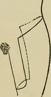 An illustration from Modern surgery, general and operative / by John Chalmers DaCosta. (1914)