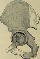 An illustration from Modern surgery, general and operative / by John Chalmers DaCosta. (1914)