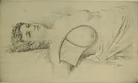 An illustration from Modern surgery, general and operative / by John Chalmers DaCosta. (1914)