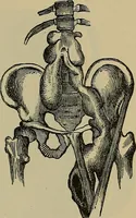 An illustration from Modern surgery, general and operative / by John Chalmers DaCosta. (1914)