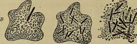 An illustration from Modern surgery, general and operative / by John Chalmers DaCosta. (1914)