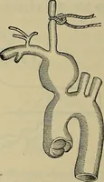 An illustration from Modern surgery, general and operative / by John Chalmers DaCosta. (1914)