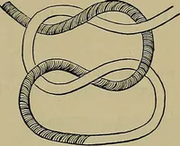 An illustration from Modern surgery, general and operative / by John Chalmers DaCosta. (1914)