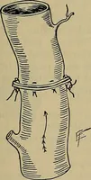 An illustration from Modern surgery, general and operative / by John Chalmers DaCosta. (1914)