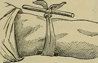 An illustration from Modern surgery, general and operative / by John Chalmers DaCosta. (1914)