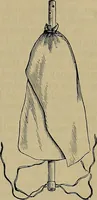 An illustration from Modern surgery, general and operative / by John Chalmers DaCosta. (1914)