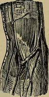 An illustration from Modern surgery, general and operative / by John Chalmers DaCosta. (1914)