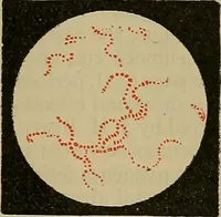 An illustration from Modern surgery, general and operative / by John Chalmers DaCosta. (1914)