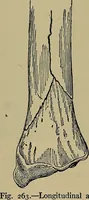 An illustration from Modern surgery, general and operative / by John Chalmers DaCosta. (1914)