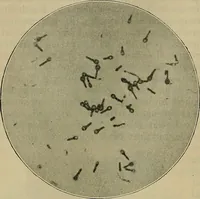An illustration from Modern surgery, general and operative / by John Chalmers DaCosta. (1914)