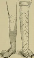 An illustration from Modern surgery, general and operative / by John Chalmers DaCosta. (1914)