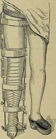 An illustration from Modern surgery, general and operative / by John Chalmers DaCosta. (1914)
