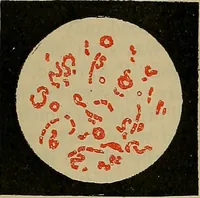 An illustration from Modern surgery, general and operative / by John Chalmers DaCosta. (1914)