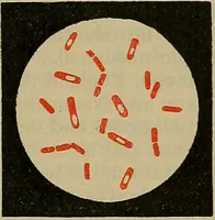 An illustration from Modern surgery, general and operative / by John Chalmers DaCosta. (1914)