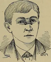 An illustration from Modern surgery, general and operative / by John Chalmers DaCosta. (1914)