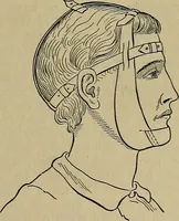 An illustration from Modern surgery, general and operative / by John Chalmers DaCosta. (1914)