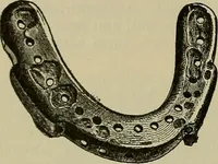 An illustration from Modern surgery, general and operative / by John Chalmers DaCosta. (1914)