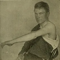 An illustration from Modern surgery, general and operative / by John Chalmers DaCosta. (1914)
