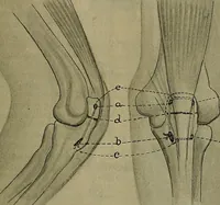 An illustration from Modern surgery, general and operative / by John Chalmers DaCosta. (1914)