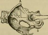 An illustration from Modern surgery, general and operative / by John Chalmers DaCosta. (1914)