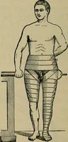 An illustration from Modern surgery, general and operative / by John Chalmers DaCosta. (1914)