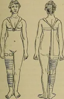 An illustration from Modern surgery, general and operative / by John Chalmers DaCosta. (1914)