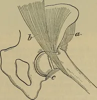 An illustration from Modern surgery, general and operative / by John Chalmers DaCosta. (1914)