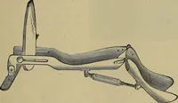 An illustration from Modern surgery, general and operative / by John Chalmers DaCosta. (1914)