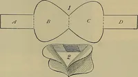An illustration from Modern surgery, general and operative / by John Chalmers DaCosta. (1914)
