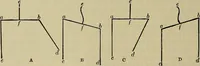 An illustration from Modern surgery, general and operative / by John Chalmers DaCosta. (1914)