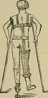 An illustration from Modern surgery, general and operative / by John Chalmers DaCosta. (1914)