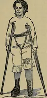 An illustration from Modern surgery, general and operative / by John Chalmers DaCosta. (1914)
