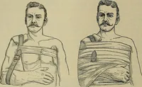 An illustration from Modern surgery, general and operative / by John Chalmers DaCosta. (1914)