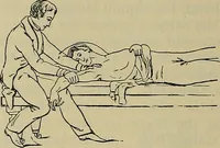 An illustration from Modern surgery, general and operative / by John Chalmers DaCosta. (1914)
