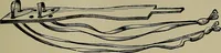 An illustration from Modern surgery, general and operative / by John Chalmers DaCosta. (1914)