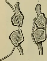 An illustration from Modern surgery, general and operative / by John Chalmers DaCosta. (1914)