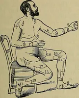 An illustration from Modern surgery, general and operative / by John Chalmers DaCosta. (1914)