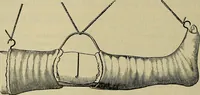 An illustration from Modern surgery, general and operative / by John Chalmers DaCosta. (1914)