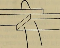 An illustration from Modern surgery, general and operative / by John Chalmers DaCosta. (1914)