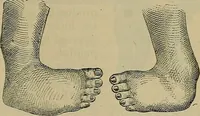 An illustration from Modern surgery, general and operative / by John Chalmers DaCosta. (1914)