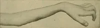 An illustration from Modern surgery, general and operative / by John Chalmers DaCosta. (1914)